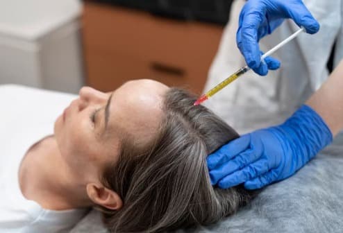Hair loss treatment