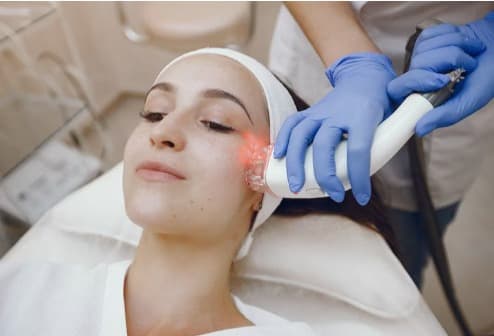 Dermal Laser